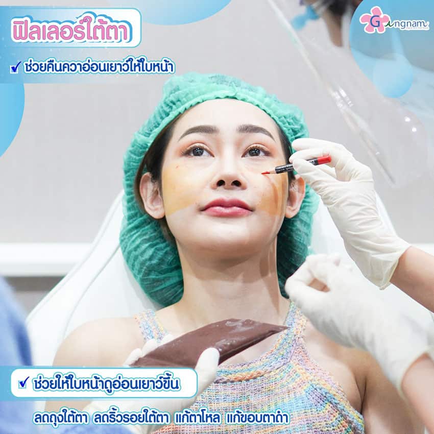 ฟิลเลอร์ช่วยแก้ปัญหาใต้ตาเรื่องอะไรบ้าง