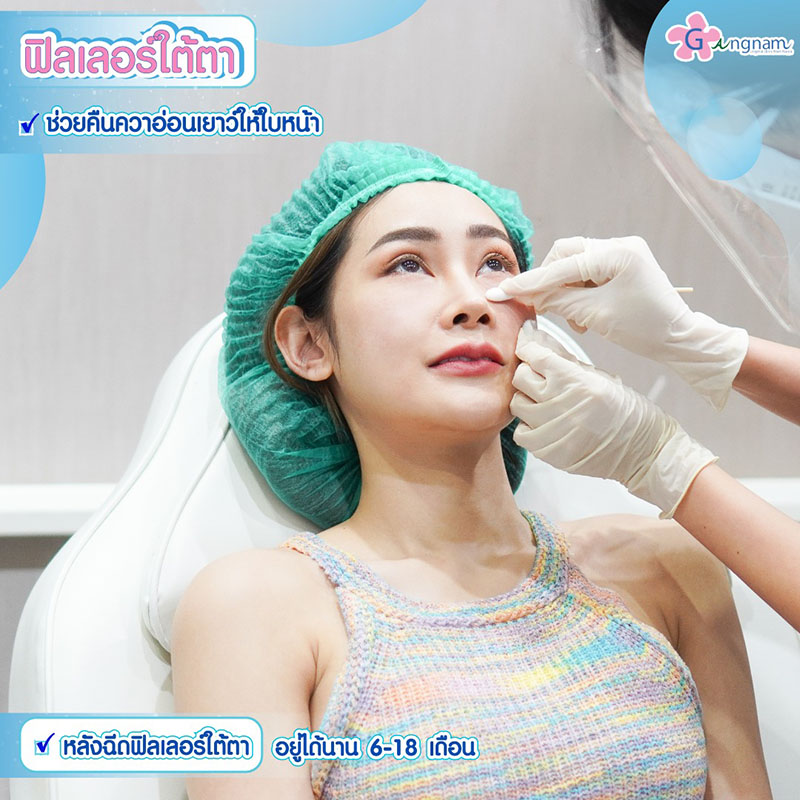 ฟิลเลอร์ใต้ตาอยู่ได้นานแค่ไหน