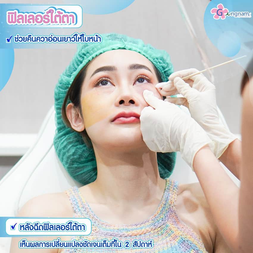 หลังฉีดฟิลเลอร์ใต้ตา กี่วันเห็นผล