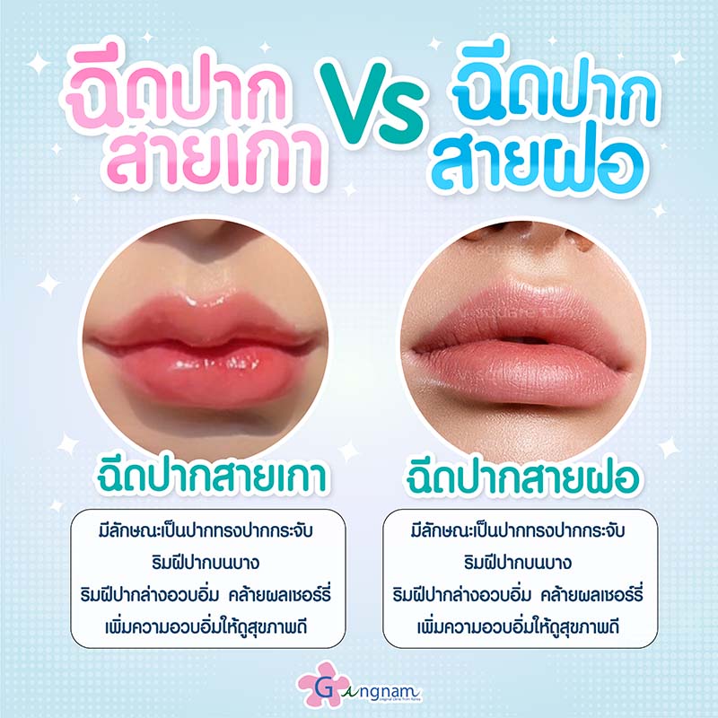 รูปทรงปากที่คนไทยนิยมฉีด