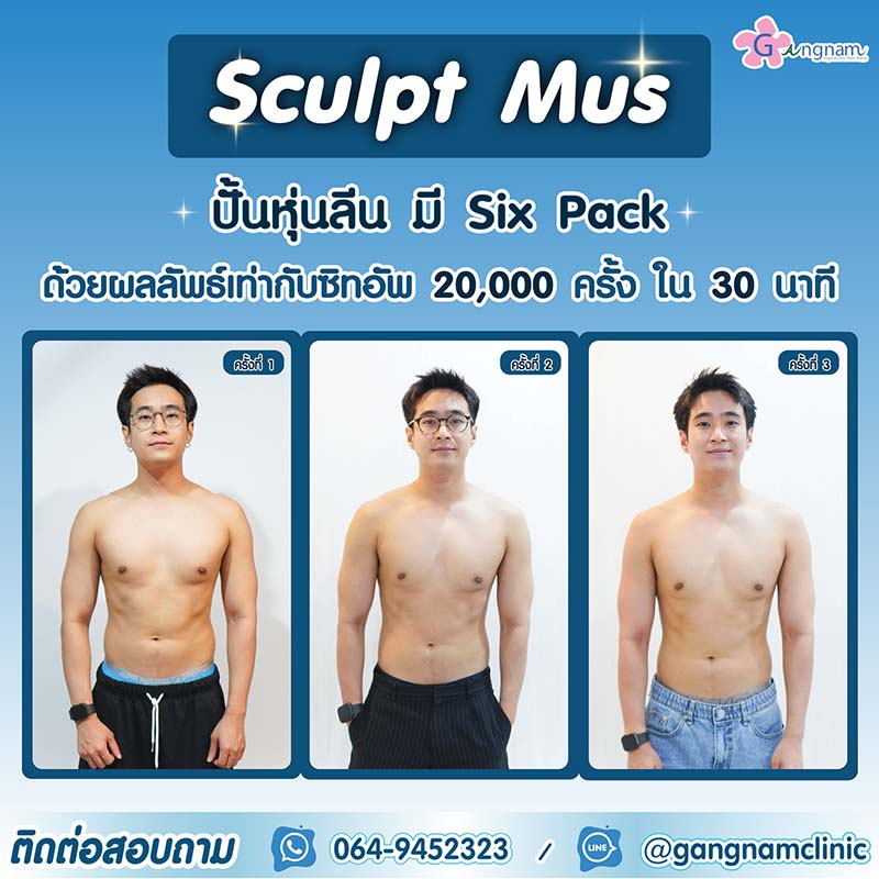 สร้างซิกแพคแบบเร่งด่วน
