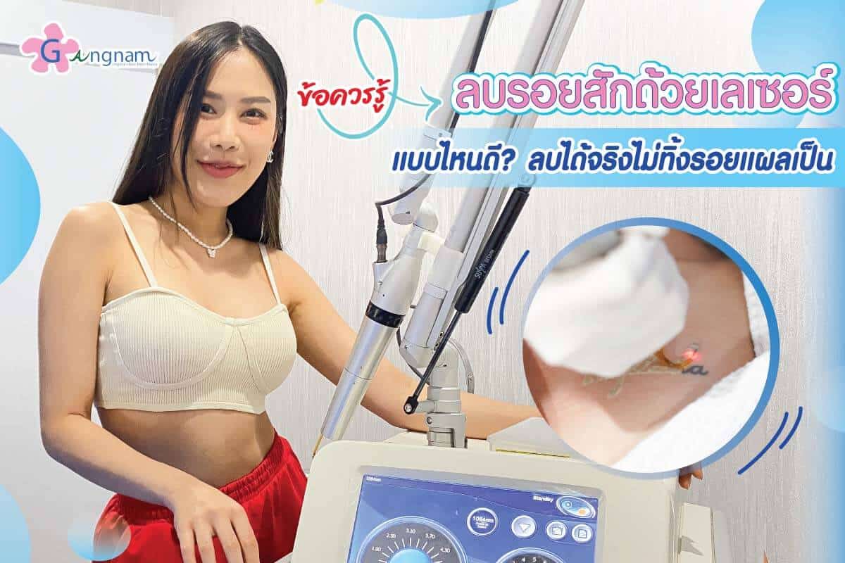 12 ข้อควรรู้ ลบรอยสักด้วยเลเซอร์ แบบไหนดี? โดยไม่เป็นรอยแผลเป็น - Gangnam Clinic 12 ข้อควรรู้ ลบรอยสักด้วยเลเซอร์ แบบไหนดี? โดยไม่เป็นรอยแผลเป็น - Gangnam Clinic