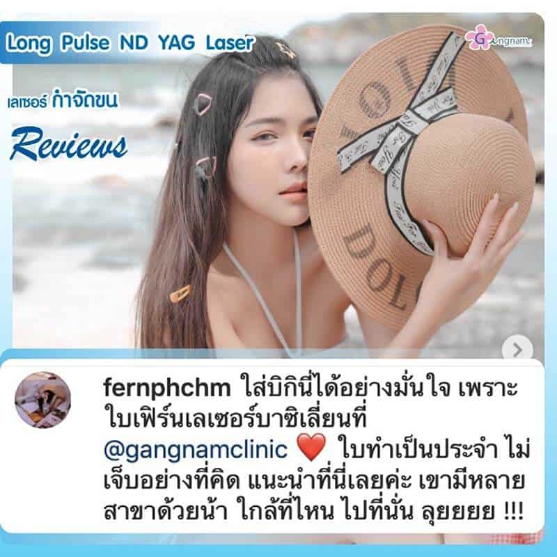 เลเซอร์ขนจิมิ กำจัดขนน้องสาว เจ็บไหม ทำครั้งแรก เตรียมตัวยังไง ทำกี่ครั้งเห็นผล เลเซอร์ขนจิมิ กำจัดขนน้องสาว เจ็บไหม ทำครั้งแรก เตรียมตัวยังไง ทำกี่ครั้งเห็นผล