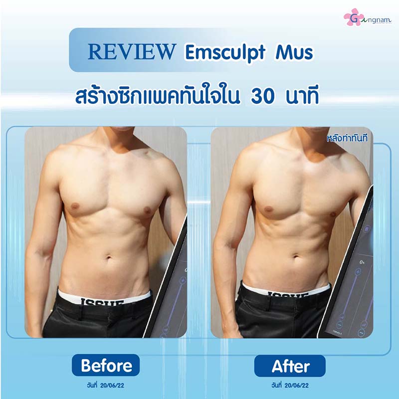 รีวิวสร้างซิกแพคด้วย sculpt mus