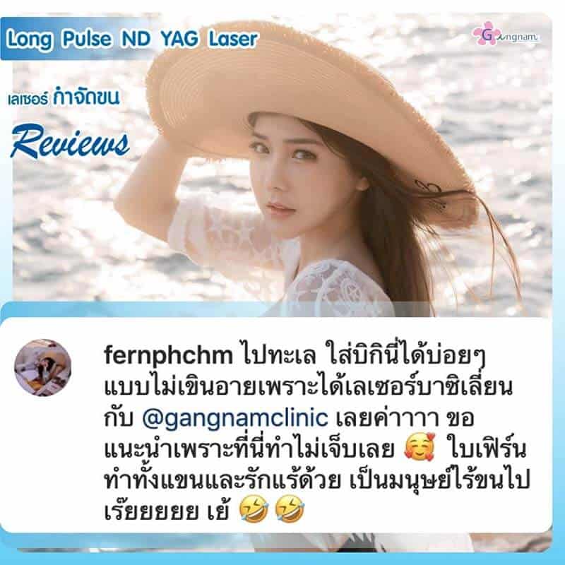 รีวิวเลเซอร์บิกินี่ ND YAG