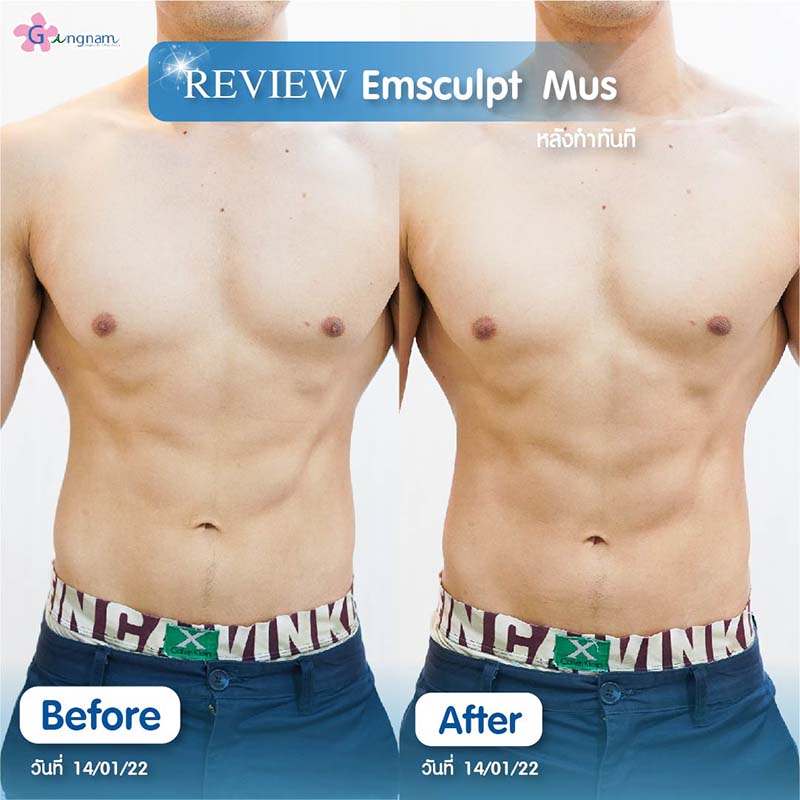 รีวิว สร้างซิกแพค ลดไขมันหน้าท้อง