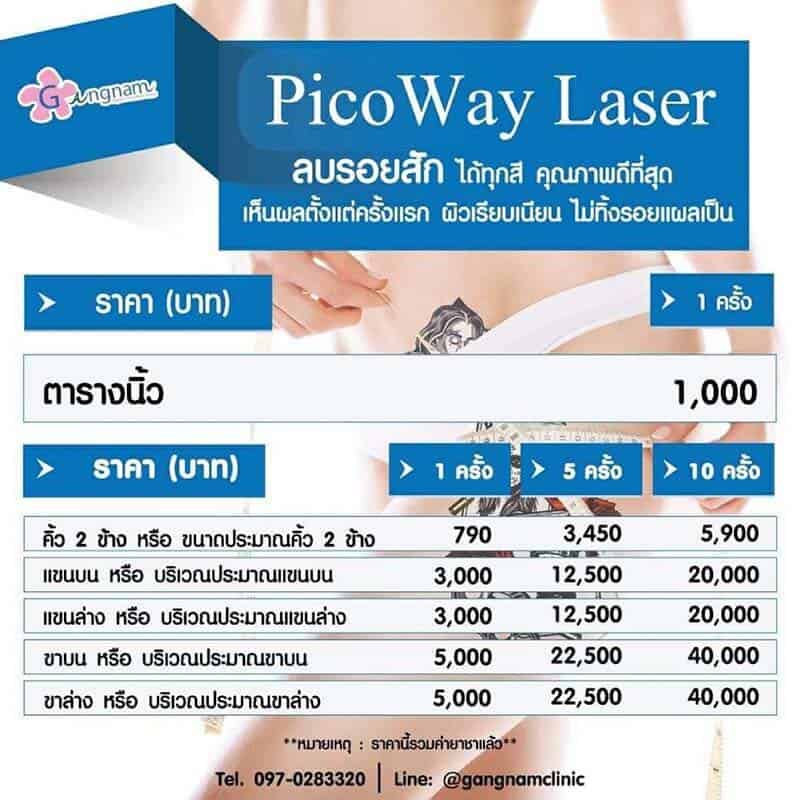 ตารางราคา เลเซอร์ลบรอยสัก