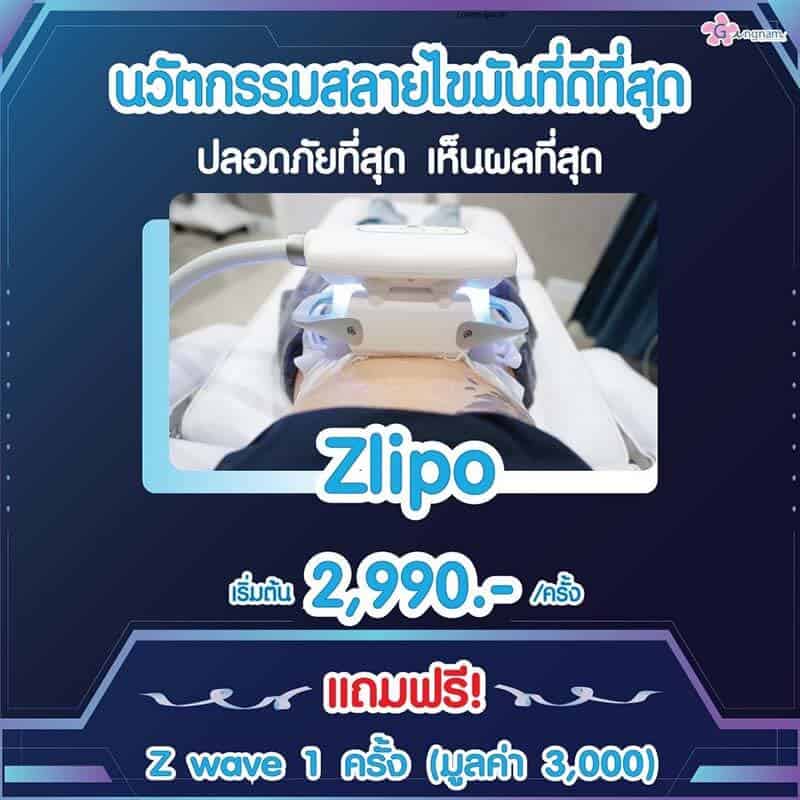 สลายไขมัน Zwave Zlipo ปลอดภัยไหม