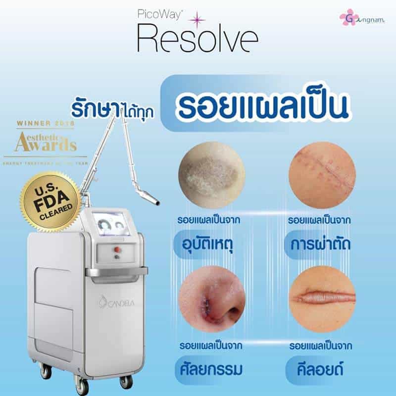 เลเซอร์รอยแตกลาย - Gangnam Clinic เลเซอร์รอยแตกลาย - Gangnam Clinic