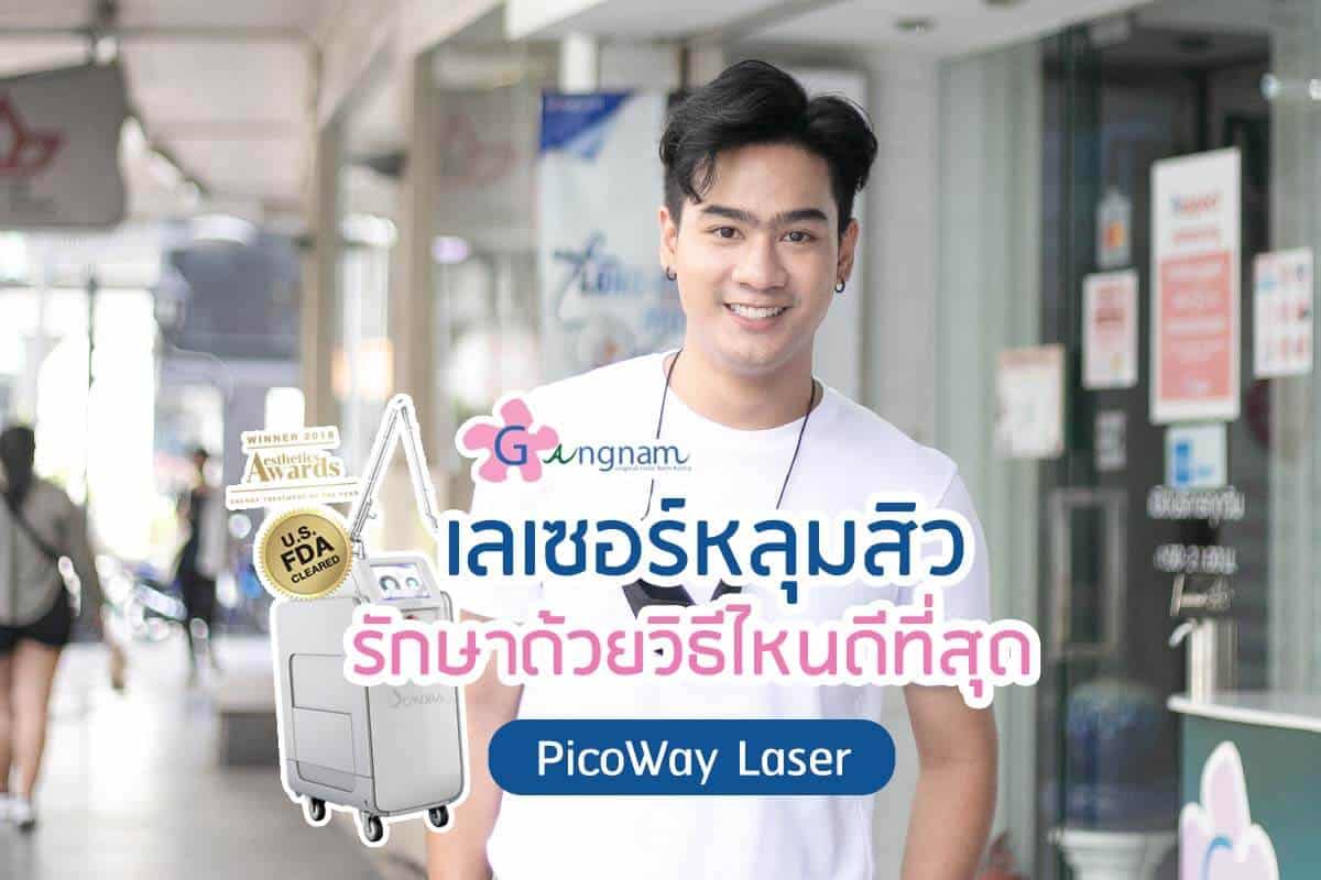 เลเซอร์หลุมสิว รักษาด้วยวิธีไหนดี