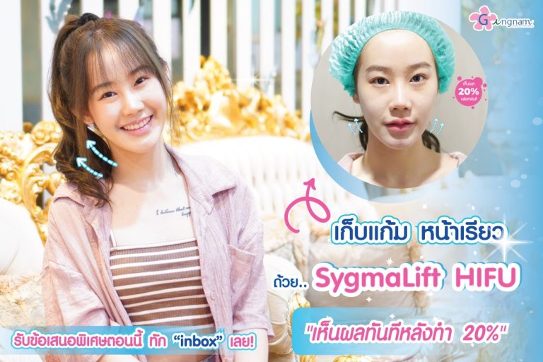 ยกกระชับหน้า Sygmalift Hifu ปรับรูปหน้าเรียว ไม่ต้องผ่าตัด