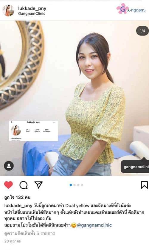 ig-review-1