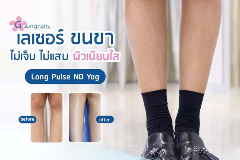 เลเซอร์ขนขา ขนหน้าแข้ง ถาวร เหมาะกับใคร? ราคาแพงไหม?