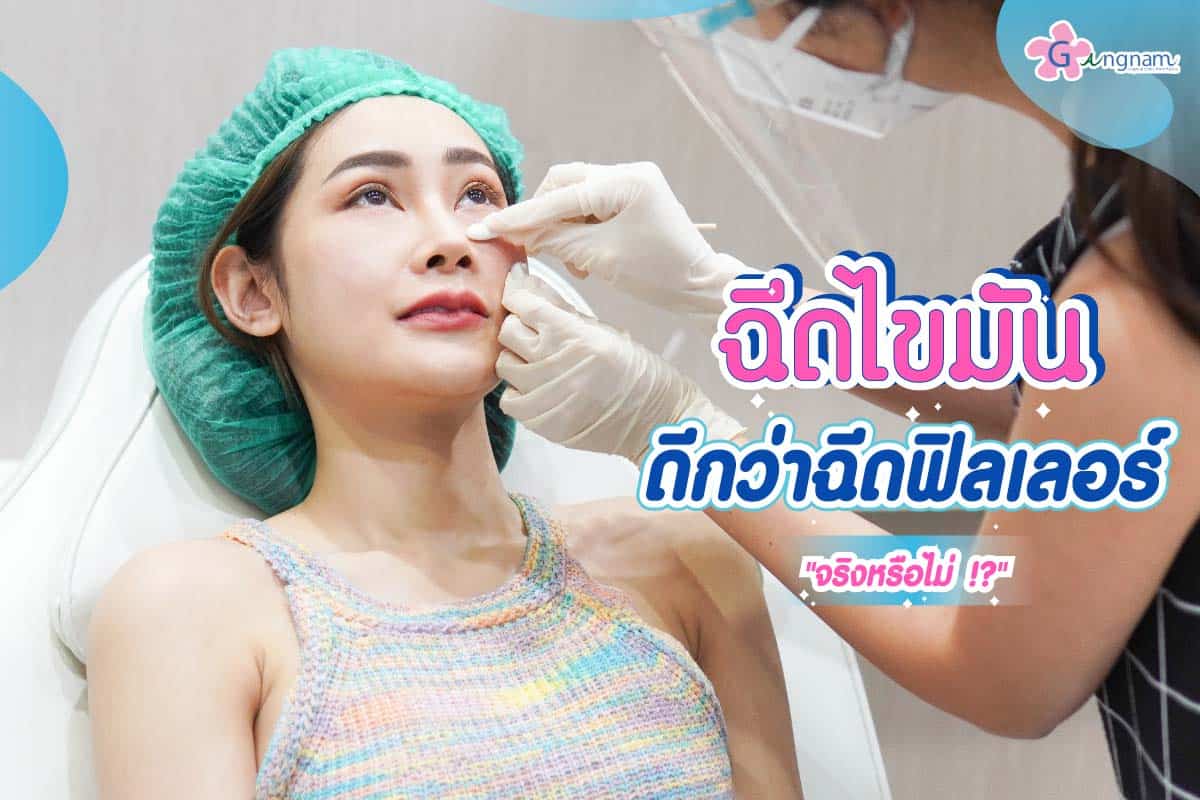 ฉีดไขมันดีกว่าฉีดฟิลเลอร์จริงไหม