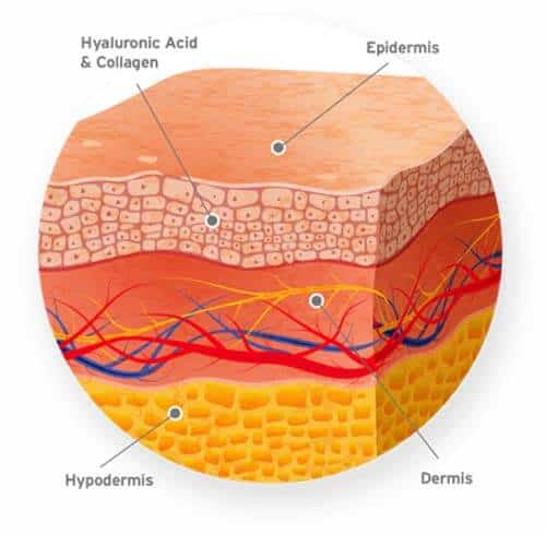 Hyaluronic-acid-คืออะไร