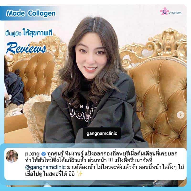 รีวิวฉีดมาเด้คอลลาเจน