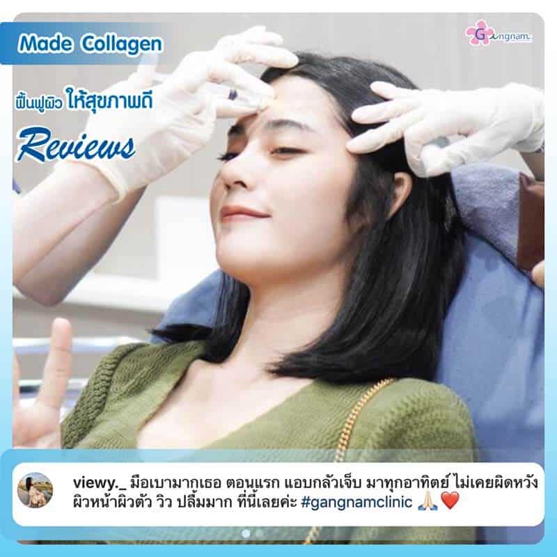 รีวิวฉีดมาเด้ฟื้นฟูผิว