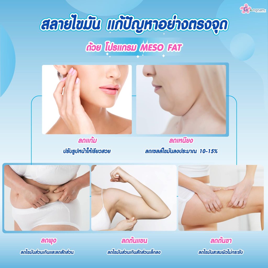เมโสแฟตแต่ละจุดช่วยแก้ปัญหาอะไร