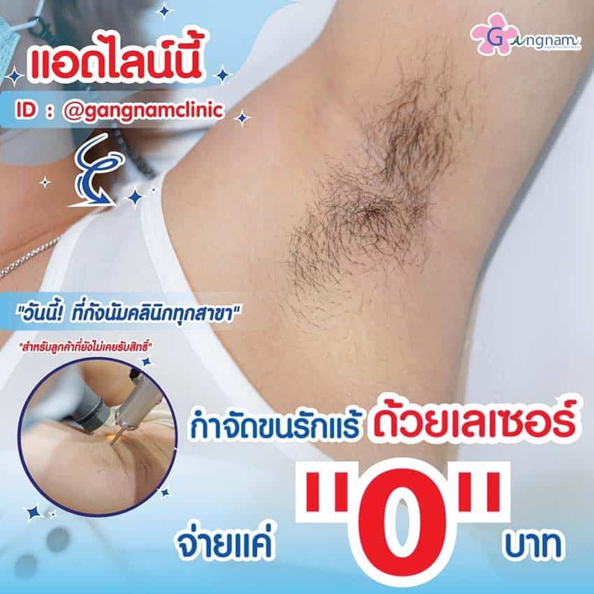 10 วิธีกําจัดขนรักแร้ ไม่ให้เป็นตอ ข้อดี-ข้อเสีย วิธีไหนให้ผลลัพธ์ถาวร แบบธรรมชาติ 10 วิธีกําจัดขนรักแร้ ไม่ให้เป็นตอ ข้อดี-ข้อเสีย วิธีไหนให้ผลลัพธ์ถาวร แบบธรรมชาติ