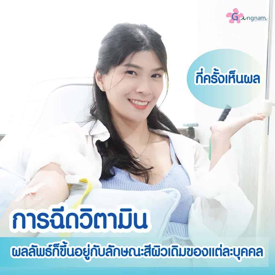 ฉีดวิตามินผิวกี่ครั้งถึงจะเห็นผล