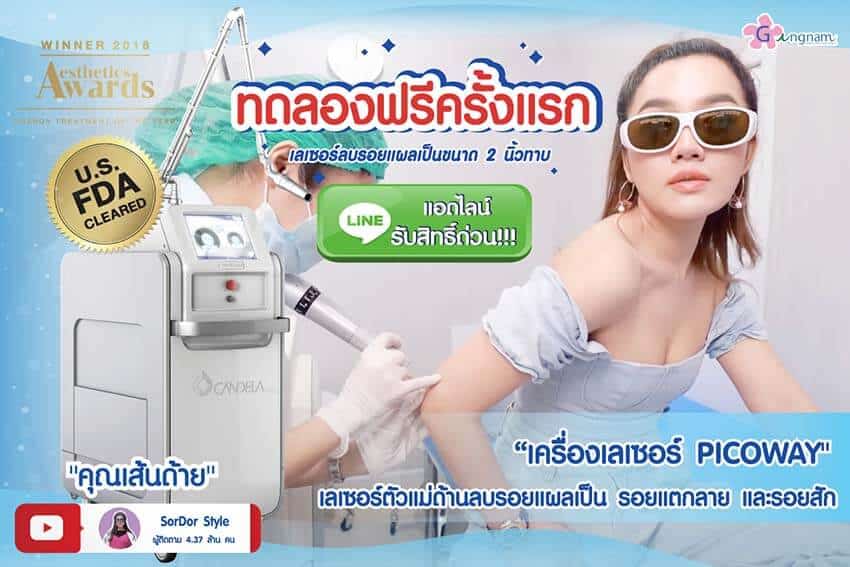 ทดลองเลเซอร์ลบรอยสักฟรีครั้งแรก