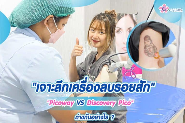 เจาะลึกเครื่องลบรอยสัก Picoway VS Discovery Pico เครื่องไหนดีกว่ากัน ต่างกันอย่างไร?