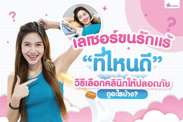 เลเซอร์ขนรักแร้ที่ไหนดี เลือกคลินิกอย่างไรให้ปลอดภัย ต้องดูอะไรบ้าง 2025