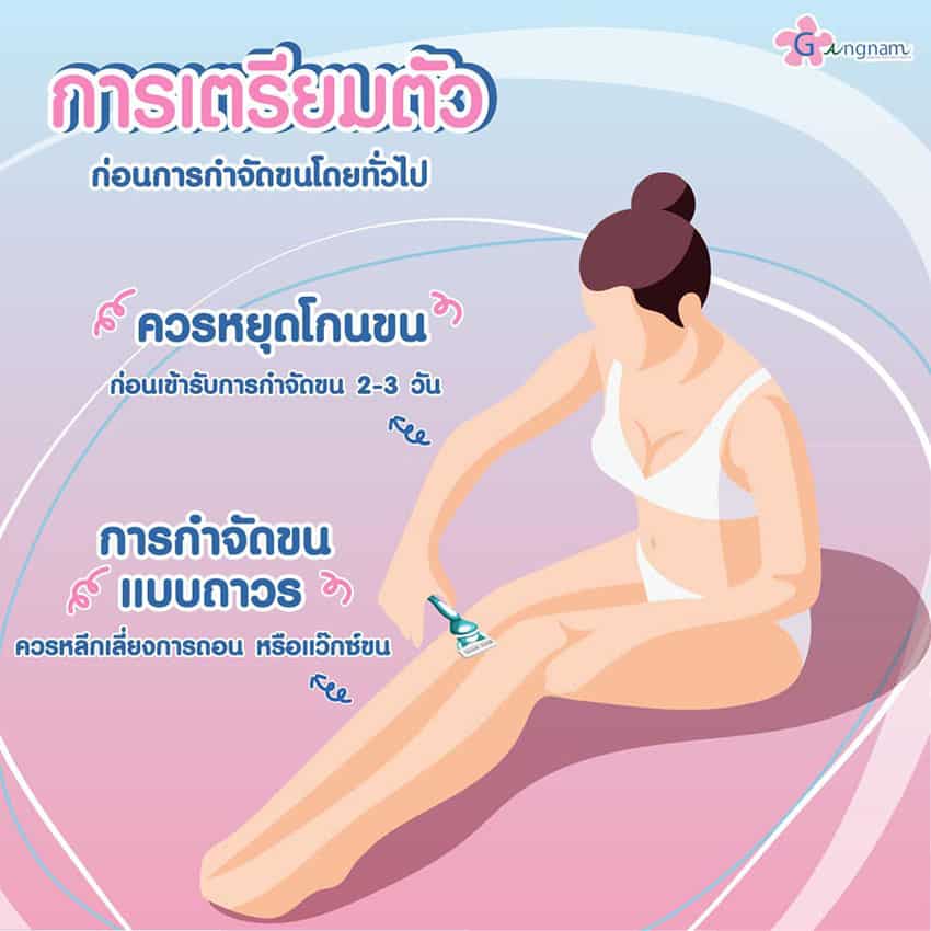 เลเซอร์ขน