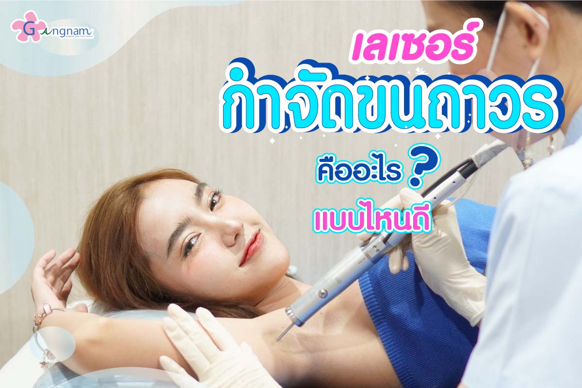 เลเซอร์กำจัดขน
