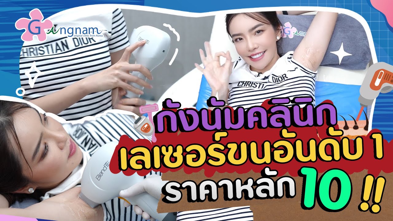 เครื่องเลเซอร์ขน