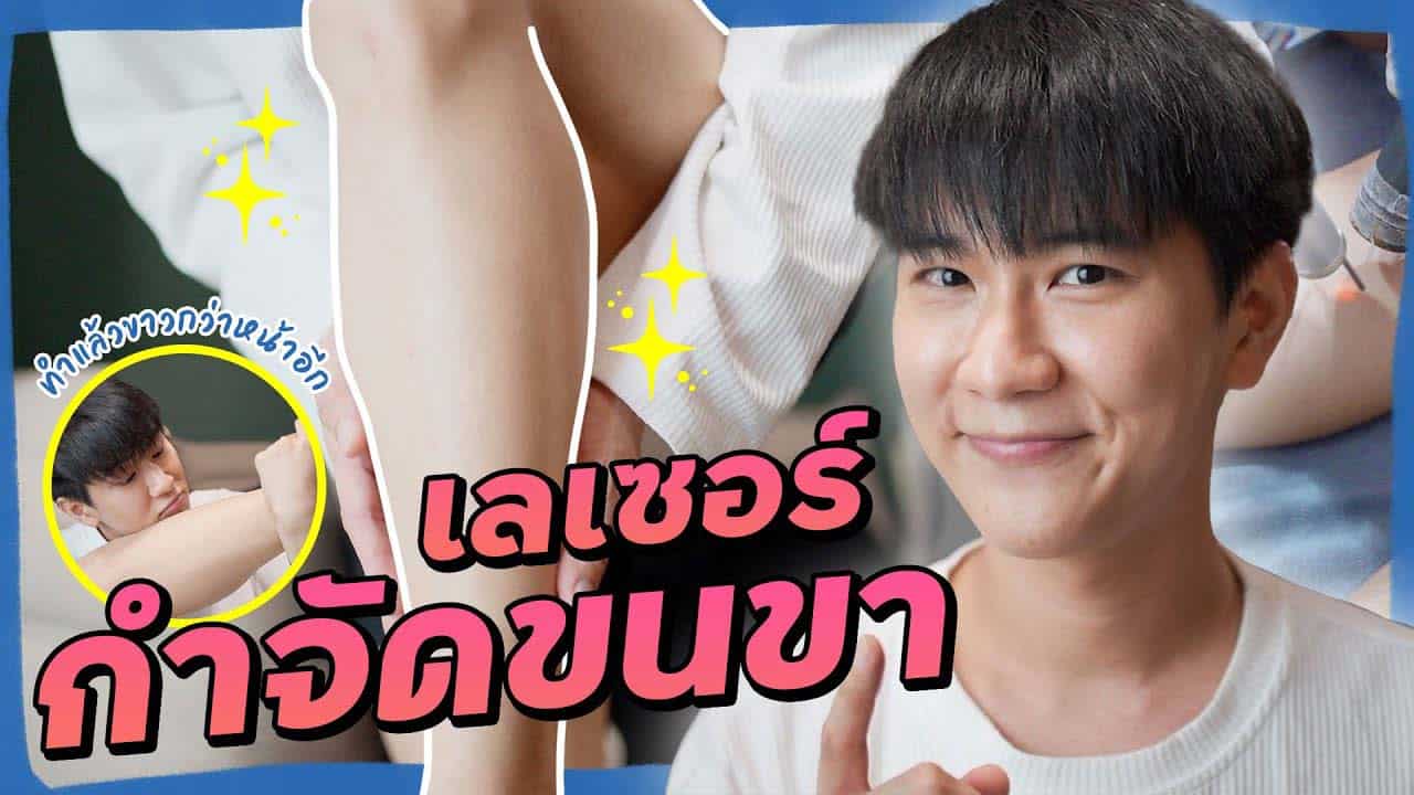 เลเซอร์กำจัดขนขา