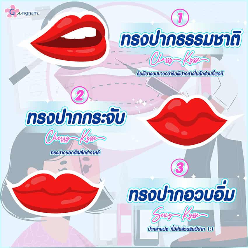 ทรงปากกระจับ