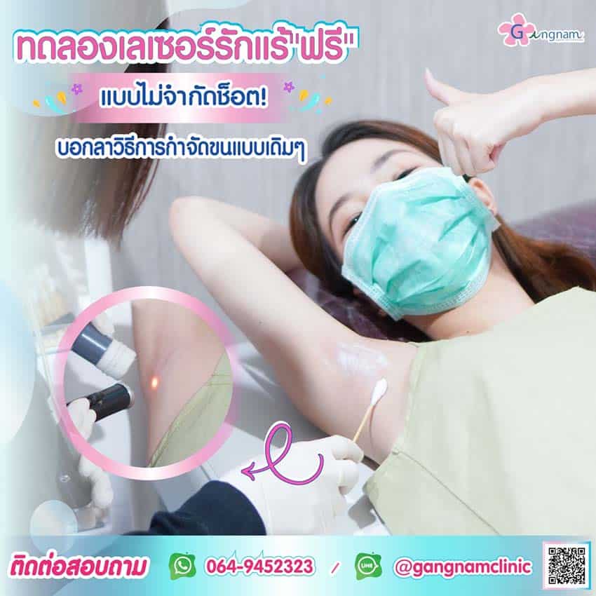 เลเซอร์กำจัดขนคุด