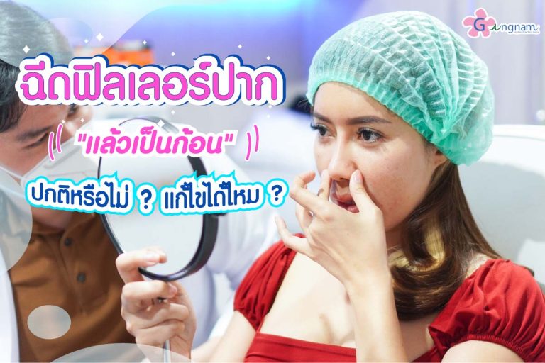 ฉีดฟิลเลอร์ปาก เป็นก้อน เกิดจาก? ก้อนแบบไหนผิดปกติ ควรต้องแก้ไขอย่างไร