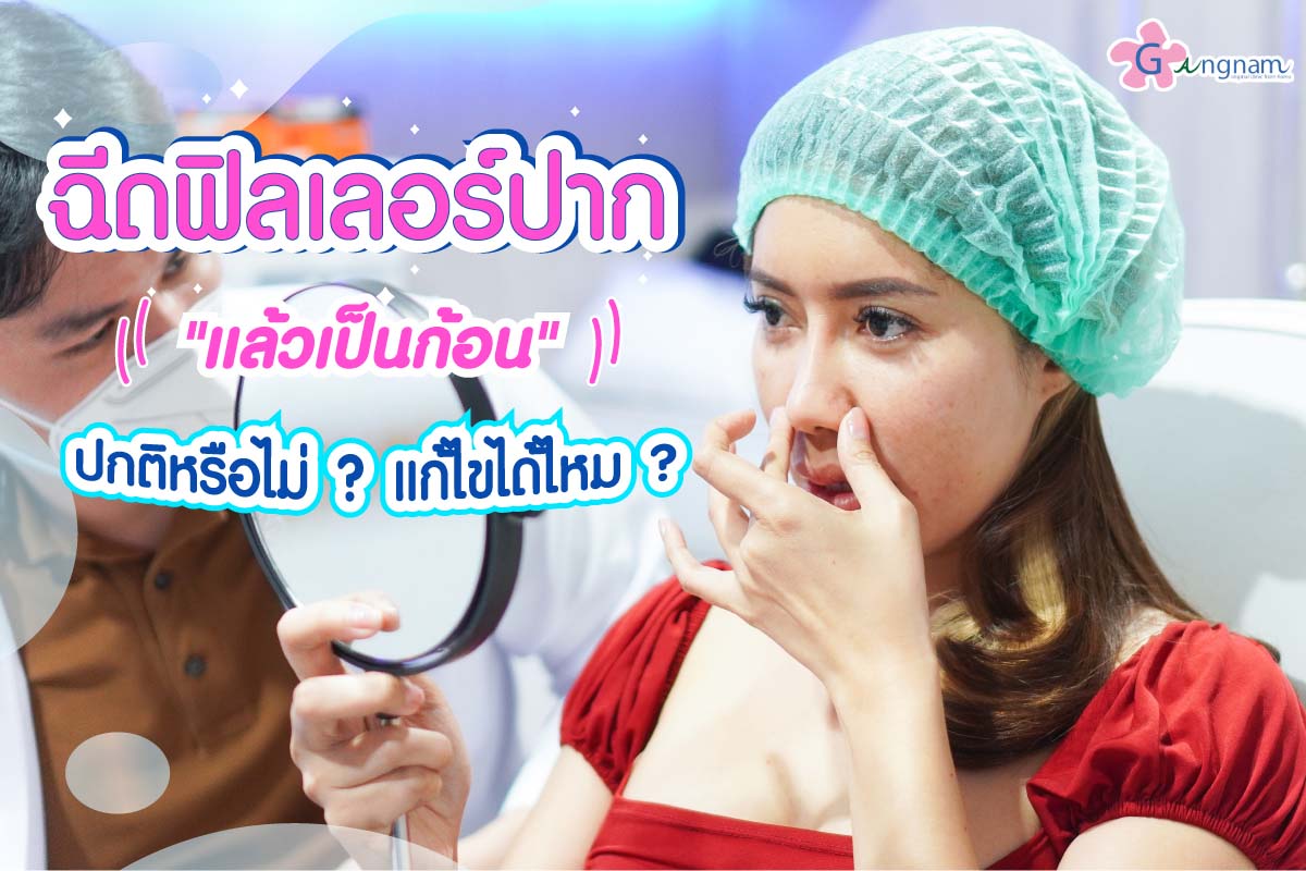 ฉีดฟิลเลอร์ปากเป็นก้อน
