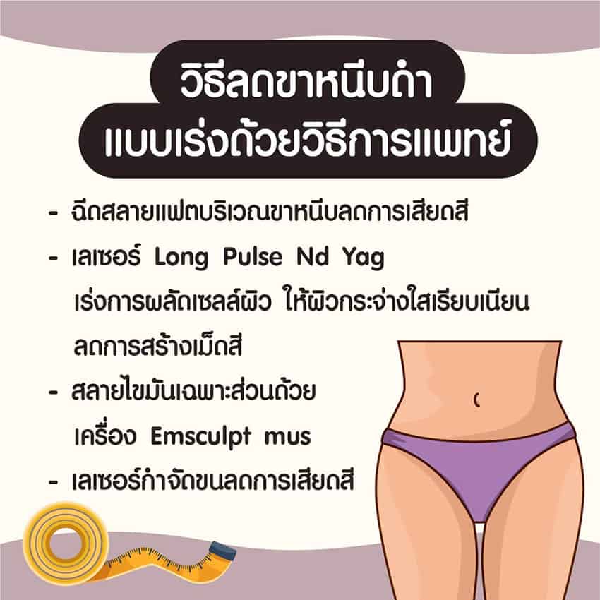 วิธีแก้ขาหนีบดำ แบบเร่งด่วน