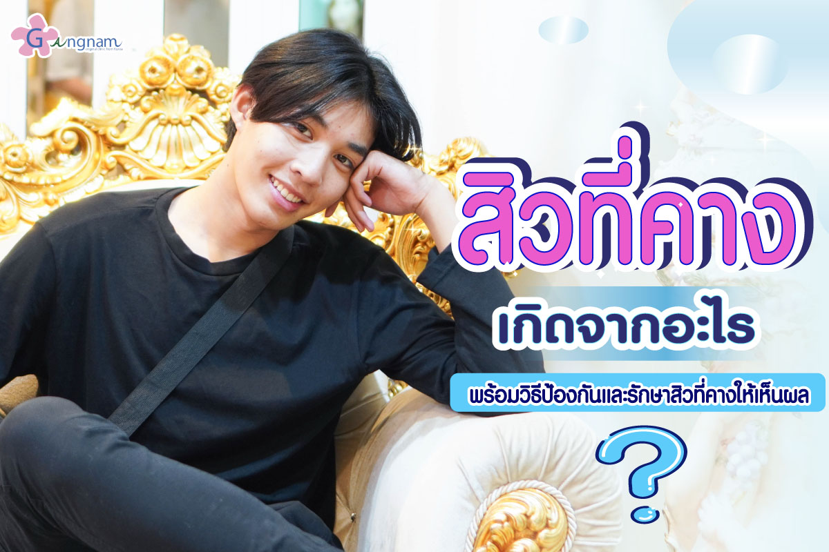 สิวที่คาง รักษาอย่างไร