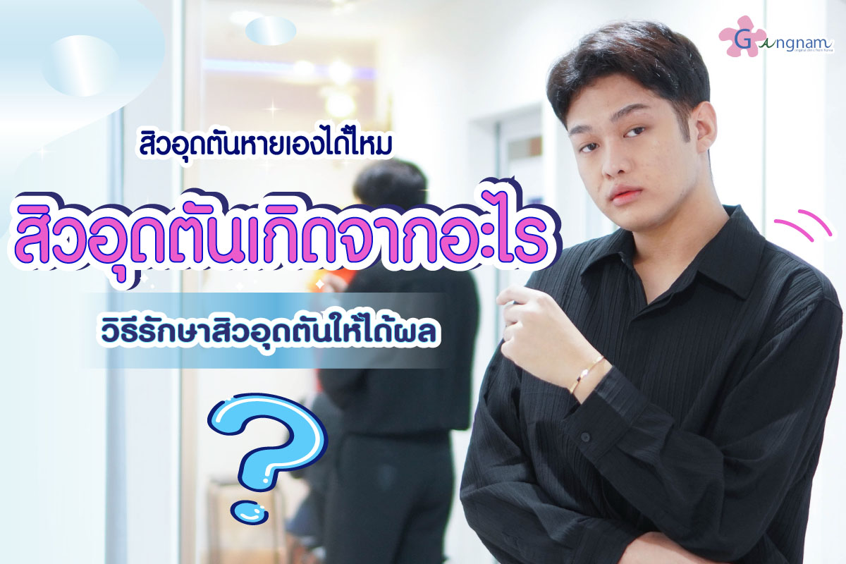 สิวอุดตัน หายเองได้ไหม