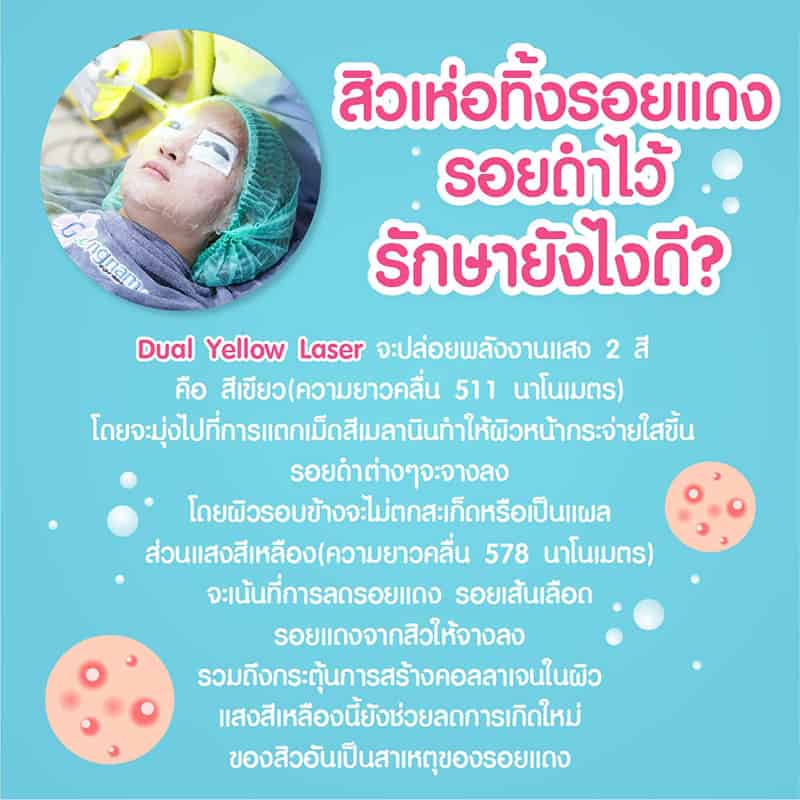สิวเห่อหนักมาก ทำไงดี? สาเหตุเกิดจากอะไร มีวิธีรักษาให้หายได้อย่างไร? - Gangnam Clinic สิวเห่อหนักมาก ทำไงดี? สาเหตุเกิดจากอะไร มีวิธีรักษาให้หายได้อย่างไร? - Gangnam Clinic