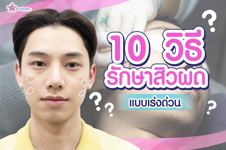 10 วิธีรักษาสิวผด แบบเร่งด่วน ให้หน้ากลับเรียบเนียนอย่างเป็นธรรมชาติ