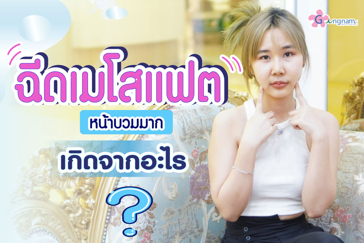 ฉีดเมโสแฟต หน้าบวมมาก