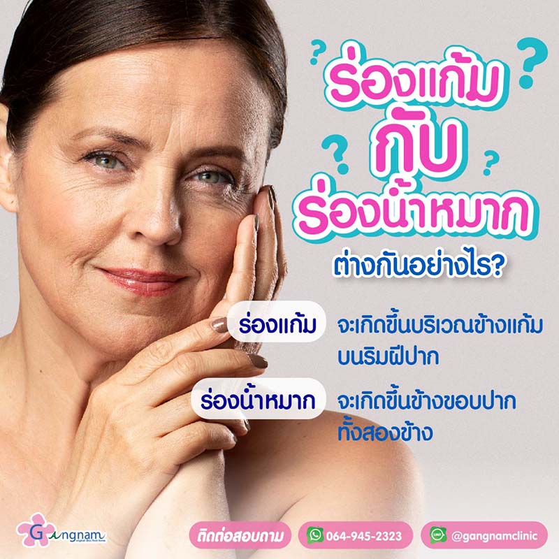 ร่องแกก้มกับร่องน้ำหมาก