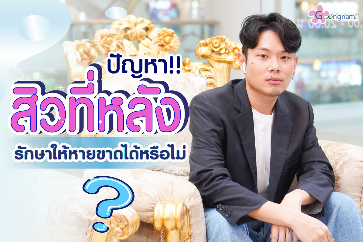 สิวที่หลัง รักษาอย่างไร