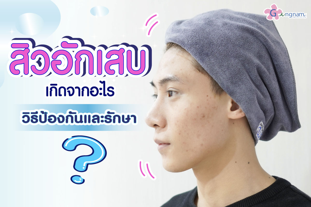 สิวอักเสบ รักษาและป้องกัน
