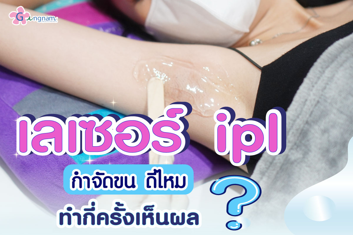 เลเซอร์ ipl กำจัดขน