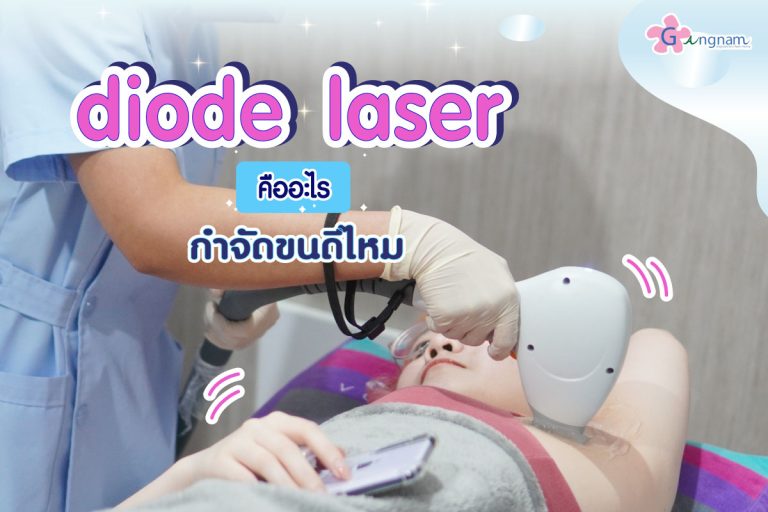 Diode Laser คืออะไร? เหมาะกับใคร? ข้อดี-ข้อเสีย ต่างกับเลเซอร์ชนิดอื่นอย่างไร