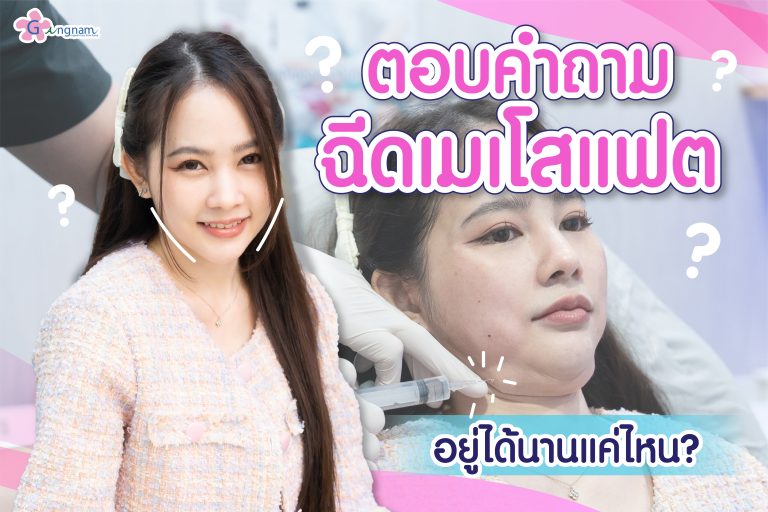 ฉีดเมโสแฟต อยู่ได้นานแค่ไหน ? ควรเติมเมื่อไหร่ และเว้นระยะการฉีดอย่างไร