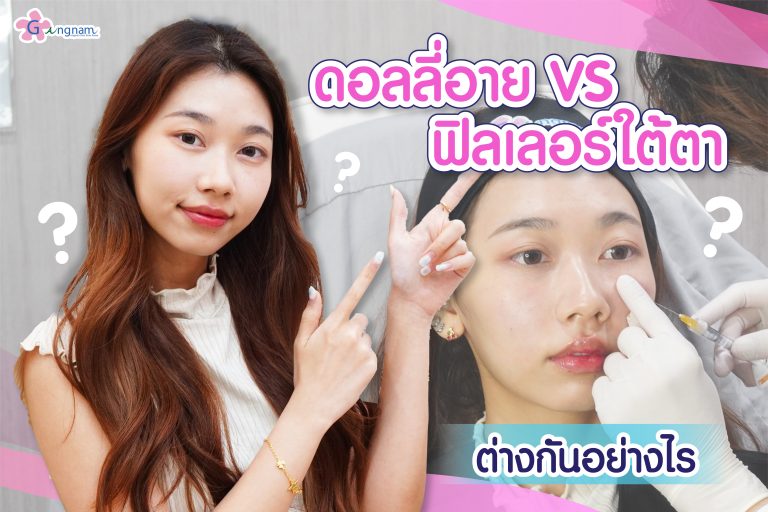 ฉีดดอลลี่อาย VS ฟิลเลอร์ใต้ตา ข้อดี-ข้อเสีย ต่างกันอย่างไร เลือกทำด้วยวิธีไหนดี