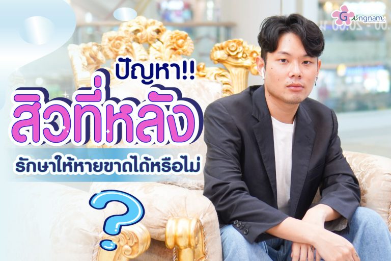 สาเหตุปัญหาสิวที่หลัง เกิดจากอะไร? พร้อมแนะนำวิธีป้องกันและรักษาให้หายขาด