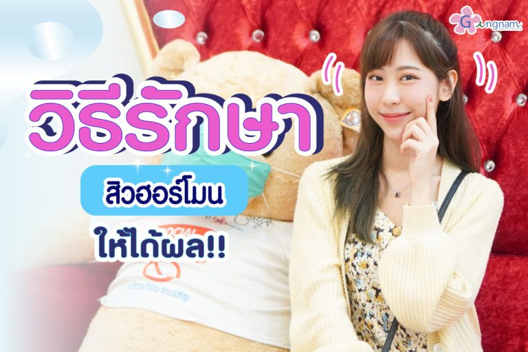 สิวฮอร์โมน เกิดจาก + วิธีรักษาสิวฮอร์โมนให้ได้ผล
